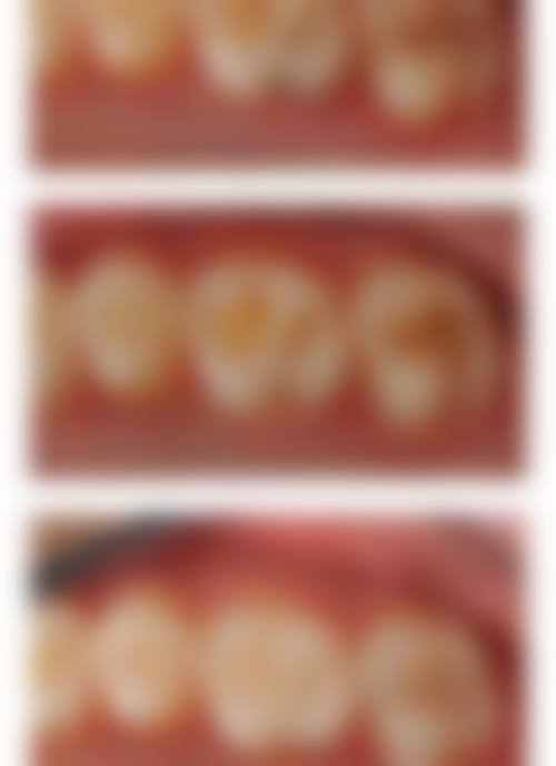 陕西咸阳爱尚齿口腔门诊部医生团队解析