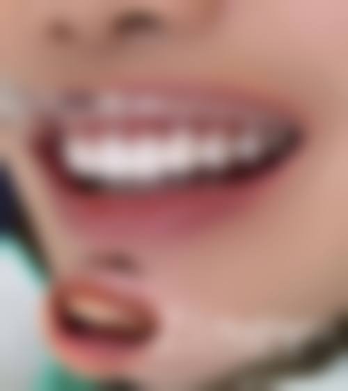 苏冬云预约方式及价格表