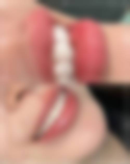 长沙叶子口腔门诊部2026价格表参考