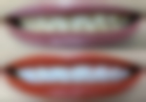 乌鲁木齐罗霞口腔诊所技术设备怎么样？