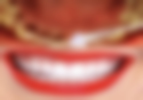 乌鲁木齐罗霞口腔诊所擅长项目有哪些？