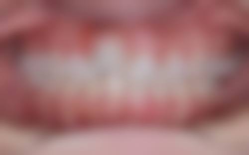 深圳霍春华口腔诊所2026价格表参考