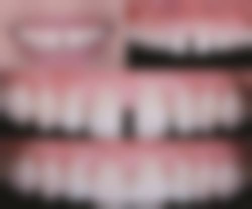 伢博仕口腔南栅擅长项目有哪些？