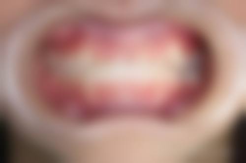 恩施善美口腔诊所擅长项目有哪些？