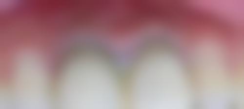 杭州临平翁梅口腔门诊口碑评价