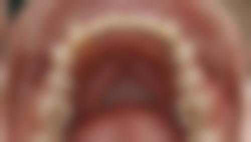 金华奈思口腔门诊部擅长项目有哪些？