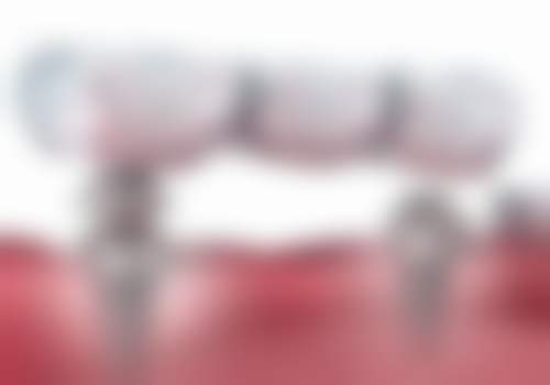 西安瑞泰口腔医院地址及到院路线