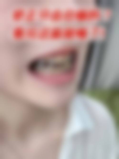 怀集县口腔医院擅长项目有哪些？