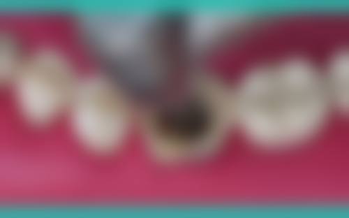 四川成都高新区固真口腔技术设备怎么样？