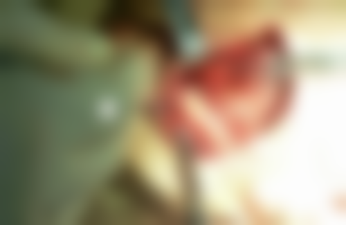 东莞叶芽口腔门诊部口碑评价