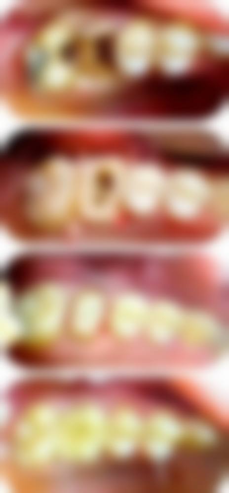 常凤预约方式及价格表