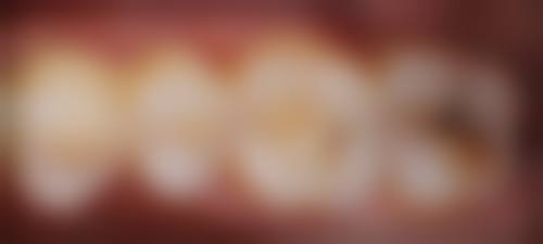 新泰杨红良口腔技术设备怎么样？