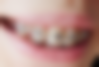 上海青苗儿童口腔（宝山门诊）擅长项目