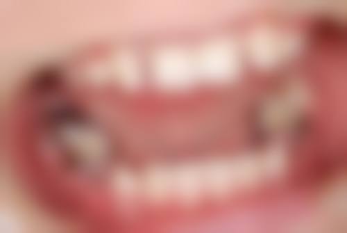 王林红擅长项目列表