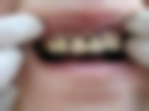 浙江温州舒芽口腔门诊部擅长项目有哪些？