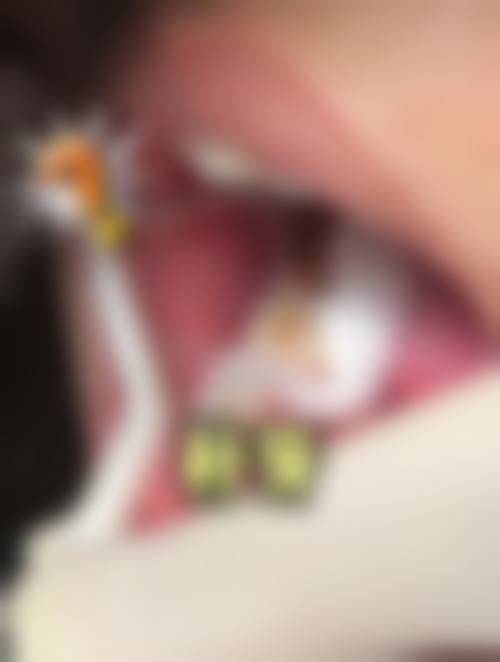 广东佛山正雅口腔擅长项目有哪些？