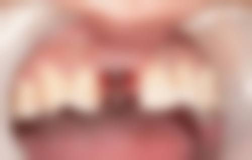 福建福州连江星成口腔口碑评价