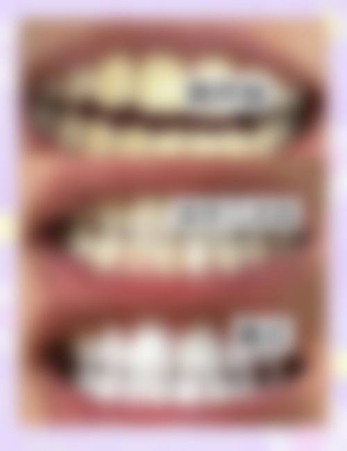 广东惠州博罗博雅口腔擅长项目有哪些?