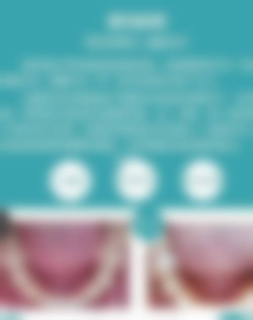 【广东肇庆博美口腔诊所常见问题解答】