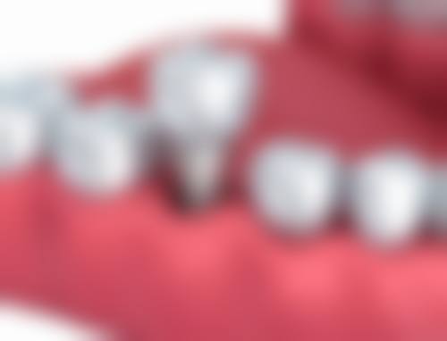 【鼎点口腔连锁门诊部常见问题解答】