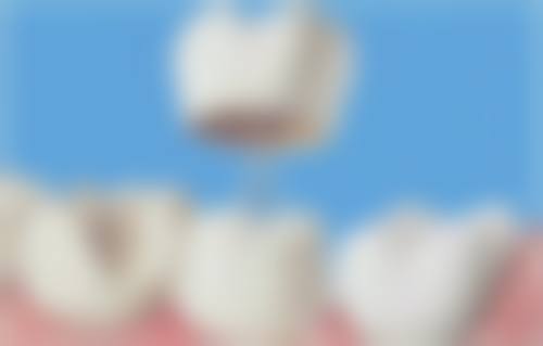 【深圳鹏盛口腔真实口碑评价】