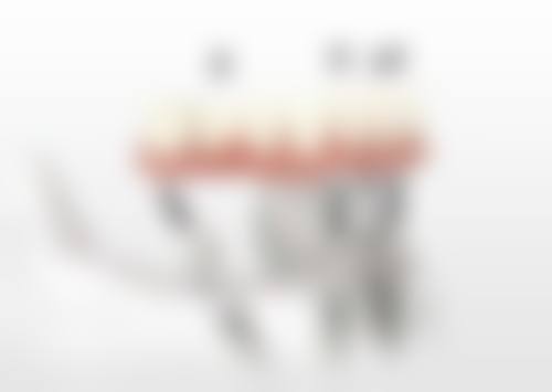 【深圳鹏盛口腔价格表参考】
