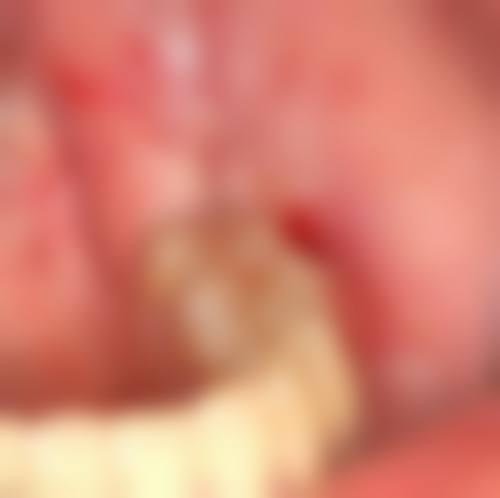 【山东淄博张店金良口腔常见问题解答】