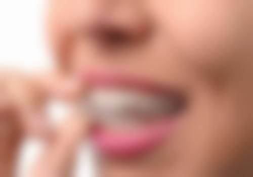 【山东潍坊高新欣雅口腔特色诊疗项目】