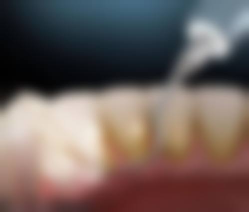 【苏州邢志东口腔(美学正畸)价格表参考】