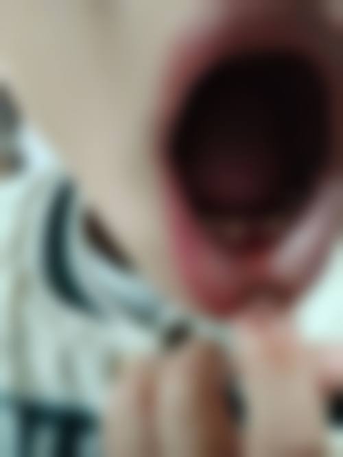 【苏州邢志东口腔(美学正畸)常见问题解答】