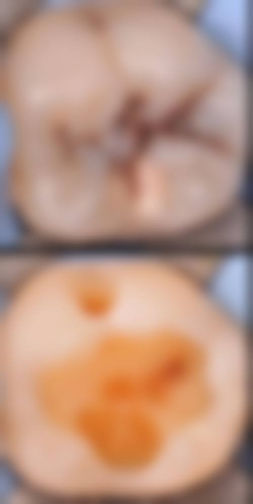 【温州康平口腔诊所价格表参考】