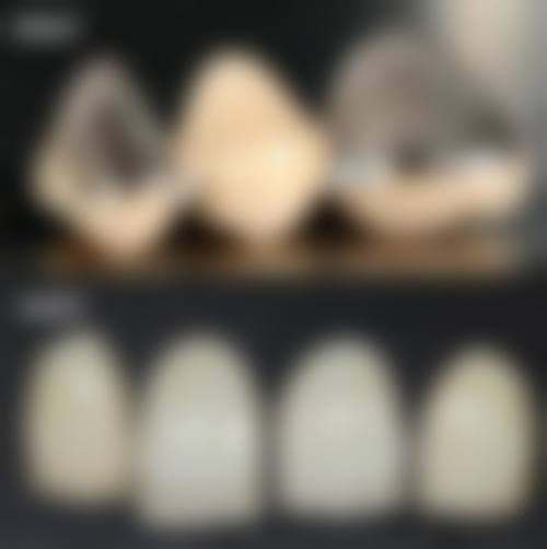 【广东广州德祥东联口腔价格参考】