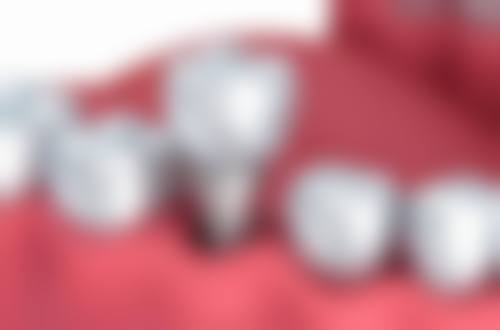 【广州蓝贝壳口腔常见问题解答(FAQ)】