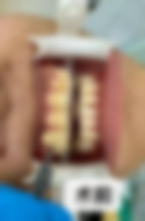 【西安长安友铭医院口腔科价格表参考】