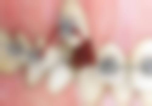 【深圳钟亮清口腔诊所骨干医生团队与技术标准】