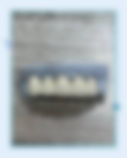 【深圳钟亮清口腔诊所参考价格表】
