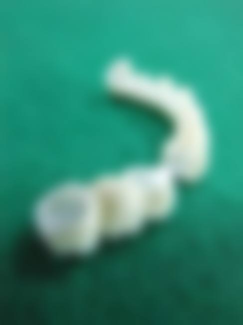 【合众口腔参考价格表】
