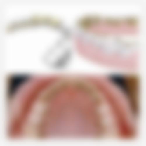 【银川惠尔美口腔诊所参考价格表】