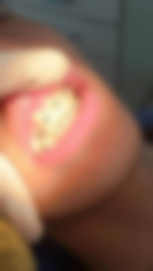 【汕头鑫雅口腔诊所真实口碑评价】