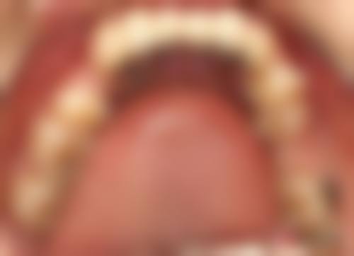 【南医七院口腔科特色诊疗项目】