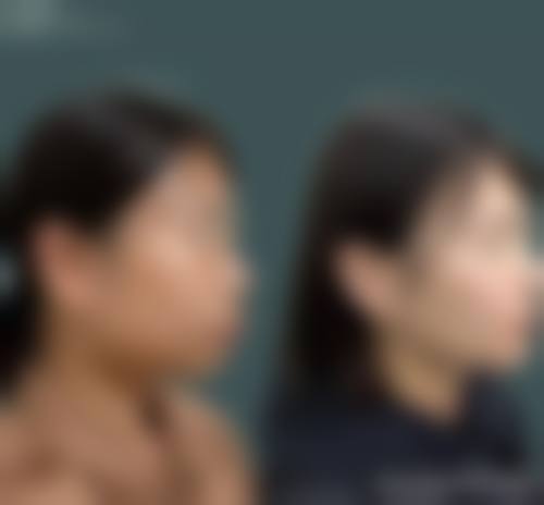 【湖北襄阳华唯口腔门诊部特色诊疗项目】