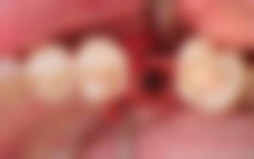 【酒泉诺贝尔口腔医院真实口碑评价】