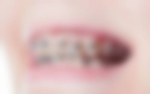 【江苏大学附属医院口腔科预约挂号方式与流程】