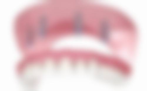 【江苏苏州太仓牙一康口腔参考价格表】