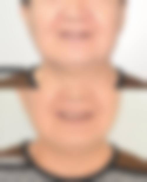 【德瓦口腔门诊部预约挂号方式与流程】