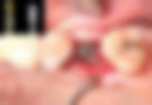 【深圳郑康口腔诊所预约挂号方式与流程】