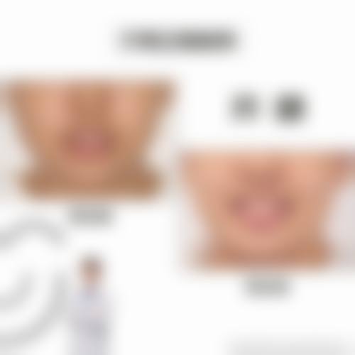 【深圳郑康口腔诊所真实口碑评价】