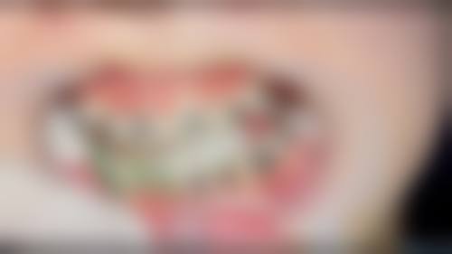 【维多利医疗美容口腔医院预约挂号方式与流程】