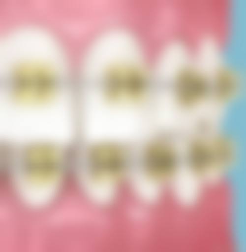【贵州新锐牙博士口腔医院参考价格表】