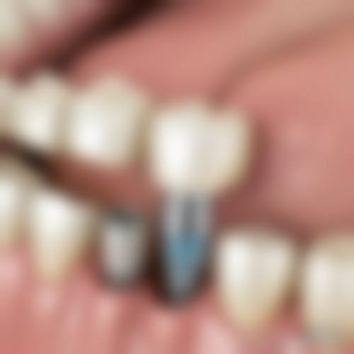 【浙江宁波余姚健齿口腔预约挂号方式与流程】